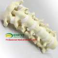 WHOLESALE SIMULATION BONE 12312 Medical Anatomy Artificial Cervical Spine , Orthopaedics Practice Simulation Bone
